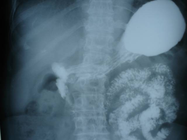  Sumer s Radiology Blog